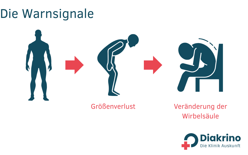 Osteoporose - Ursachen, Symptome und Behandlungsmöglichkeiten(1)