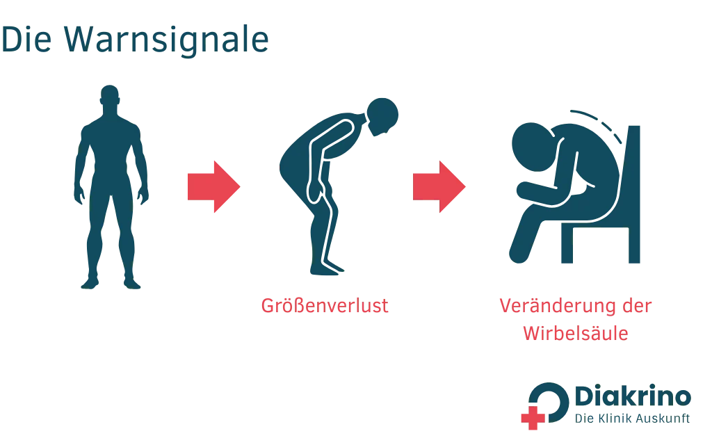 Osteoporose - Ursachen, Symptome und Behandlungsmöglichkeiten(1) Osteoporose - Ursachen, Symptome und Behandlungsmöglichkeiten(1)